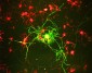 Anti-Neurofilament NF-M Antibody