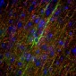 Anti-Neurofilament NF-M Antibody