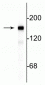 Anti-Neurofilament NF-M Antibody