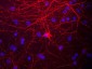 Anti-Neurofilament NF-M Antibody