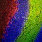 Anti-Neurofilament NF-M Antibody