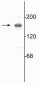 Anti-NMDA NR2A Subunit (100 ul) Antibody