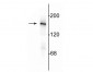 Anti-NMDA NR2A Subunit Antibody