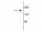 Anti-NMDA NR2B Subunit Antibody