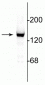 Anti-NMDA NR2C Subunit Antibody