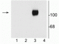 Anti-NMDA NR1 Subunit, Splice Variant C1 Antibody