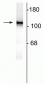 Anti-NMDA NR1 Subunit Antibody