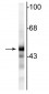 Anti-NSE (Neuron specific enolase) Antibody