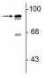 Anti-Periostin C-terminal Antibody