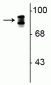 Anti-Periostin pan Antibody