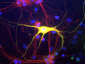 Anti-Peripherin Antibody