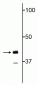 Anti-TDP43 Antibody