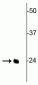 Anti-TFAM (Transcription Factor A, mitochondrial) Antibody