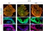 Anti-Troponin I (cardiac) Antibody