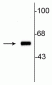 Anti-Tyrosine Hydroxylase Antibody