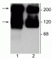 Anti-Metabotropic Glutamate Receptor 5/1a Antibody