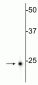 Anti-Ubiquitin C-terminal Hydrolase 1 (UCHL1) Antibody