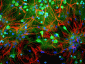 Anti-Ubiquitin C-terminal Hydrolase 1 (UCHL1) Antibody