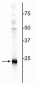 Anti-Ubiquitin C-terminal Hydrolase 1 (UCHL1) Antibody