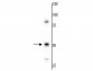 Anti-Vimentin Antibody