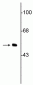 Anti-Vimentin Antibody