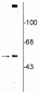 Anti-Vesicular Monoamine Transporter 2, C-terminus (VMAT2) Antibody