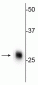 Anti-Calbindin Antibody