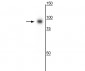 Anti-CD71 Antibody