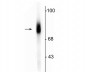 Anti-Dopamine ß-Hydroxylase, C-Terminus Antibody