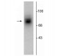 Anti-Dopamine Transporter, Extracellular Loop 2 Antibody