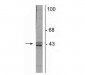 Anti-Doublecortin Antibody