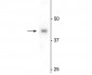 Anti-eIF4A2 Antibody