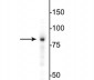 Anti-EWS Antibody