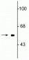 Anti-FTO (Fat mass and obesity related protein) Antibody