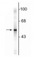 Anti-Glial Fibrillary Acidic Protein (GFAP) Antibody