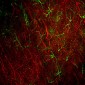 Anti-Glial Fibrillary Acidic Protein (GFAP) Antibody