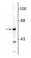 Anti-Glial Fibrillary Acidic Protein (GFAP) Antibody