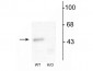 Anti-GABAA Receptor α1 Antibody