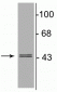 Anti-GABAA Receptor γ2 Antibody