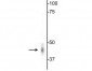 Anti-GABAA Receptor γ2 Antibody