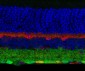 Anti-GABAA Receptor γ2 Antibody