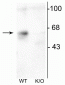 Anti-GABAA Receptor α6 Antibody