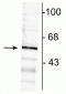 Anti-GABAA Receptor α6 Antibody