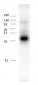 Anti-GABAA Receptor ß3 Antibody