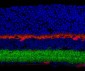 Anti-GABAA Receptor ß3 Antibody