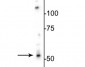 Anti-GABAA Receptor ß3 Antibody