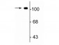 Anti-GluR1 Antibody