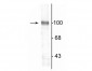 Anti-GluR2 Antibody