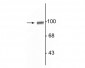 Anti-GluR2/3 Antibody