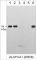 Anti-ALDH1A1 (N-terminal region) Antibody